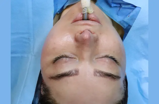 جراحی ویکتوریا صورت سینه شکم