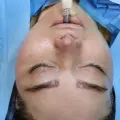 جراحی ویکتوریا صورت سینه شکم