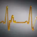 اتوسرویس کاسترول