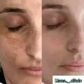 کلینیک زیبایی لیانا